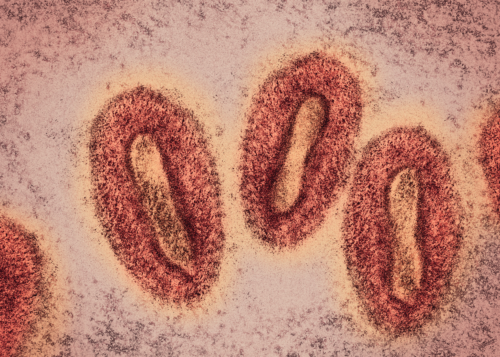 Estimation of local transmissibility in the early phase of monkeypox epidemic in 2022
