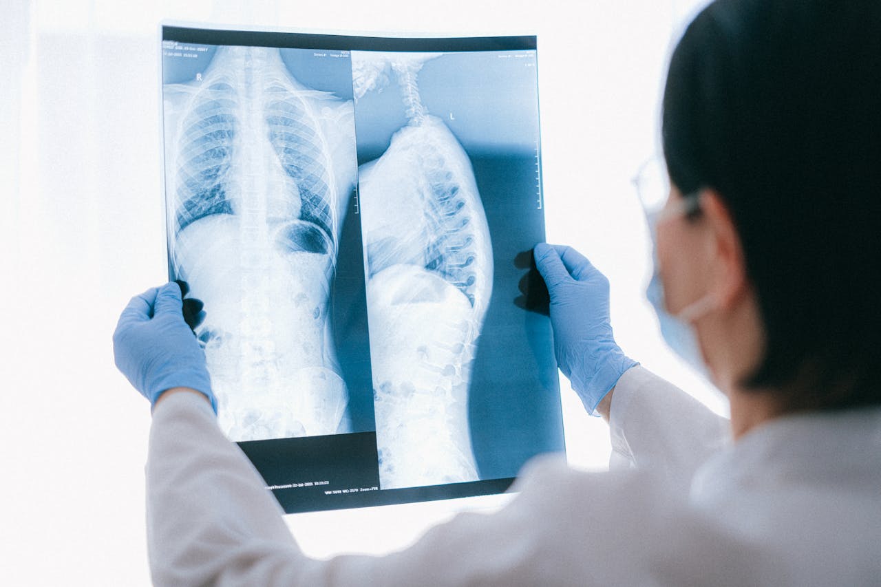 Distribution, Risk Factors, and Temporal Trends for Lung Cancer Incidence and Mortality A Global Analysis